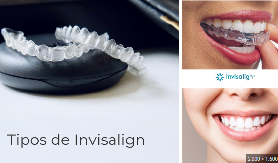 tipos de invisalign